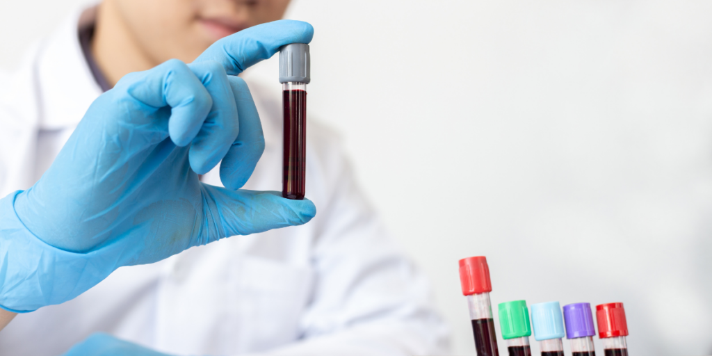 nurse with vial of blood for blood test